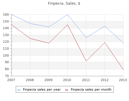 order finpecia 1 mg with visa