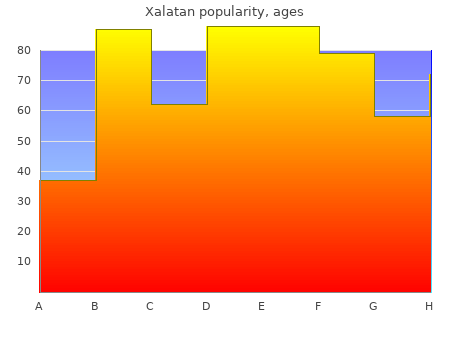 buy xalatan 2.5 ml overnight delivery