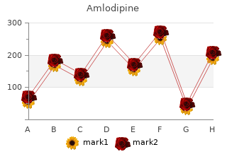 purchase 10 mg amlodipine with amex