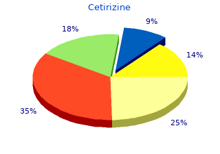 discount 5 mg cetirizine with amex