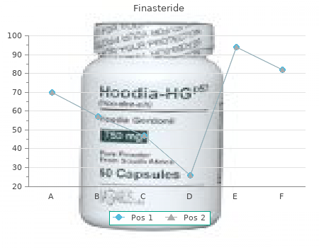 finasteride 1 mg amex